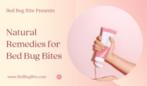 Natural Remedies for Bed Bug Bites
