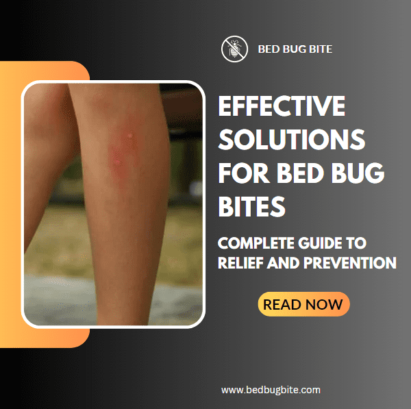 Solutions for Bed Bug Bites