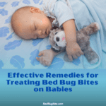 Treating Bed Bug Bites on Babies