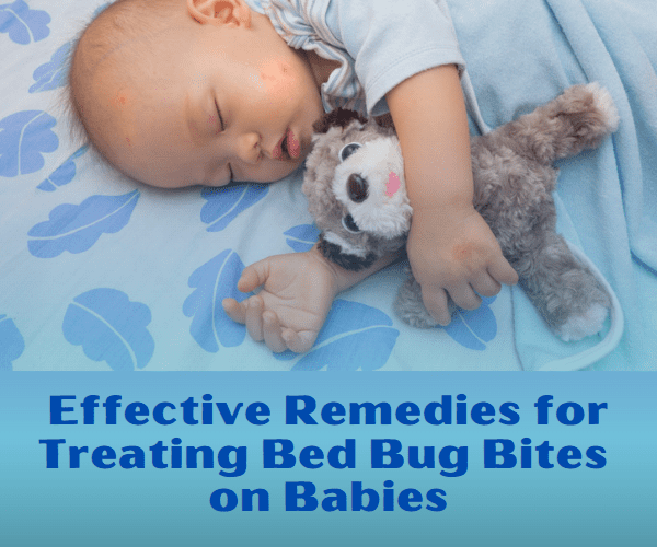 Treating Bed Bug Bites on Babies